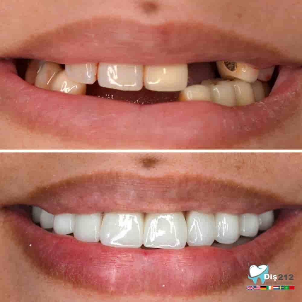 Verifizierte Patientenbewertungen von Dis 212 - Dental Aesthetics Facility in Istanbul, Turkey Slider image 2