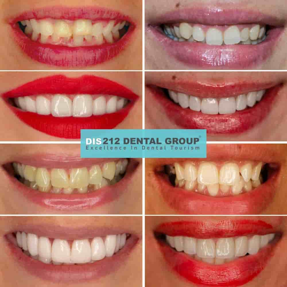 Verifizierte Patientenbewertungen von Dis 212 - Dental Aesthetics Facility in Istanbul, Turkey Slider image 3