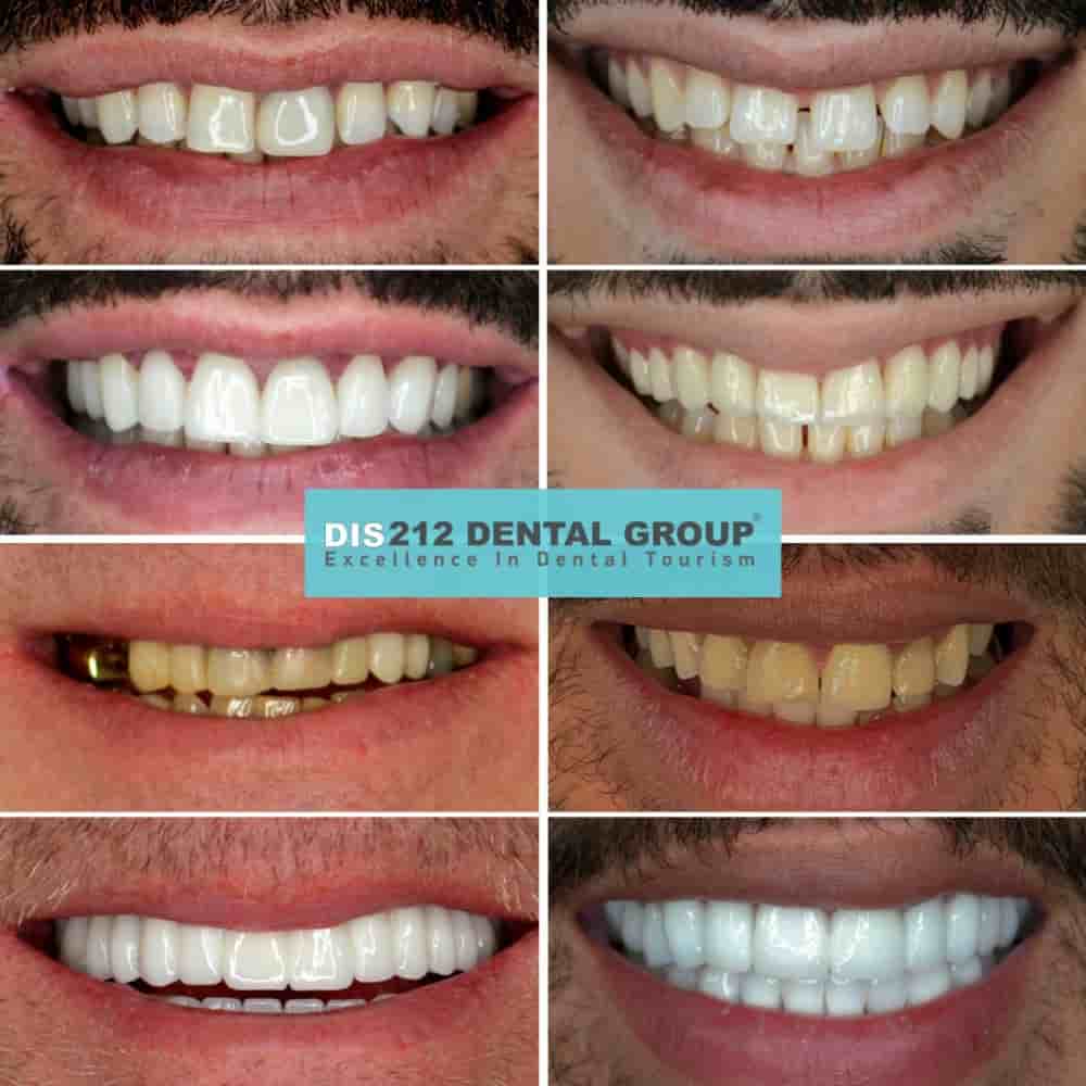 Verifizierte Patientenbewertungen von Dis 212 - Dental Aesthetics Facility in Istanbul, Turkey Slider image 4