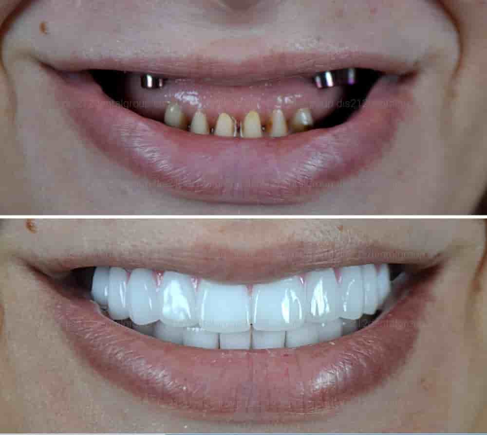 Verifizierte Patientenbewertungen von Dis 212 - Dental Aesthetics Facility in Istanbul, Turkey Slider image 6