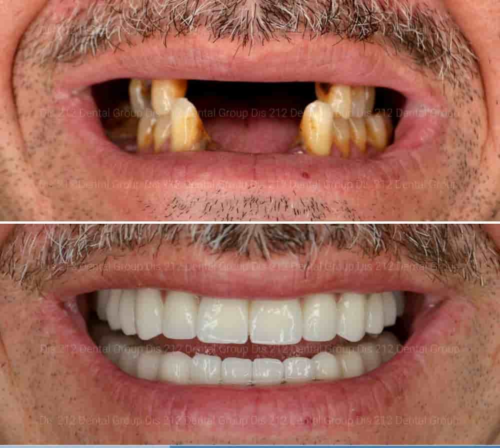 Verifizierte Patientenbewertungen von Dis 212 - Dental Aesthetics Facility in Istanbul, Turkey Slider image 7