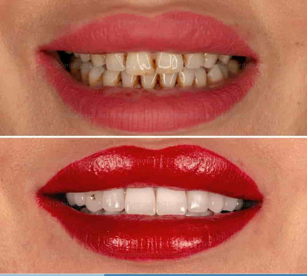 Verifizierte Patientenbewertungen von Dis 212 - Dental Aesthetics Facility in Istanbul, Turkey Slider image 9