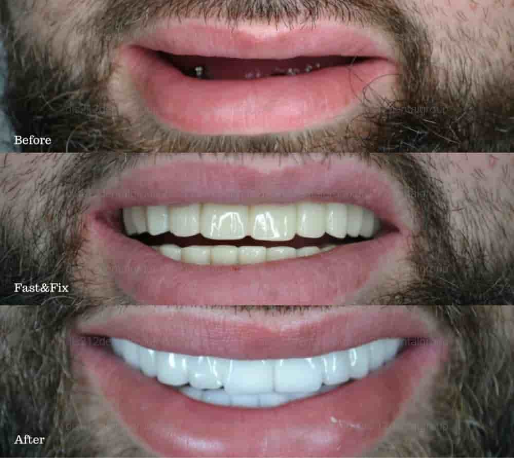 Verifizierte Patientenbewertungen von Dis 212 - Dental Aesthetics Facility in Istanbul, Turkey Slider image 10
