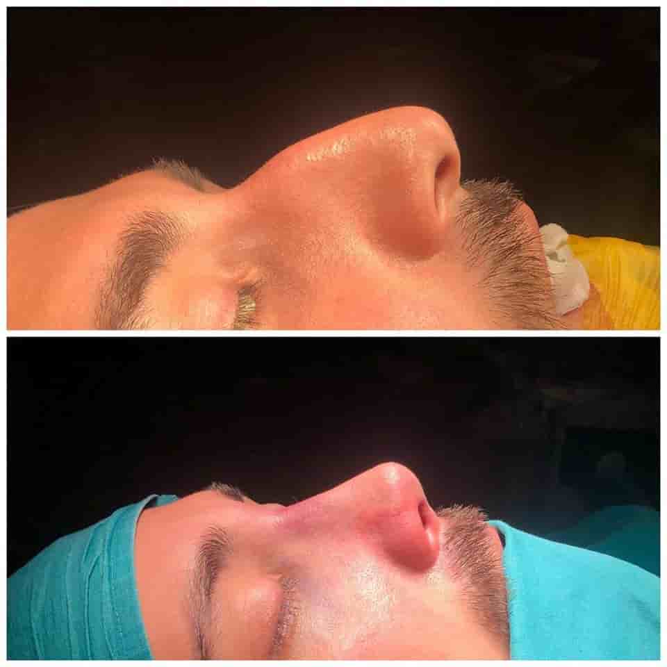 Verifizierte Patientenbewertungen von Istanbulesthe Clinic in Istanbul, Turkey Slider image 2