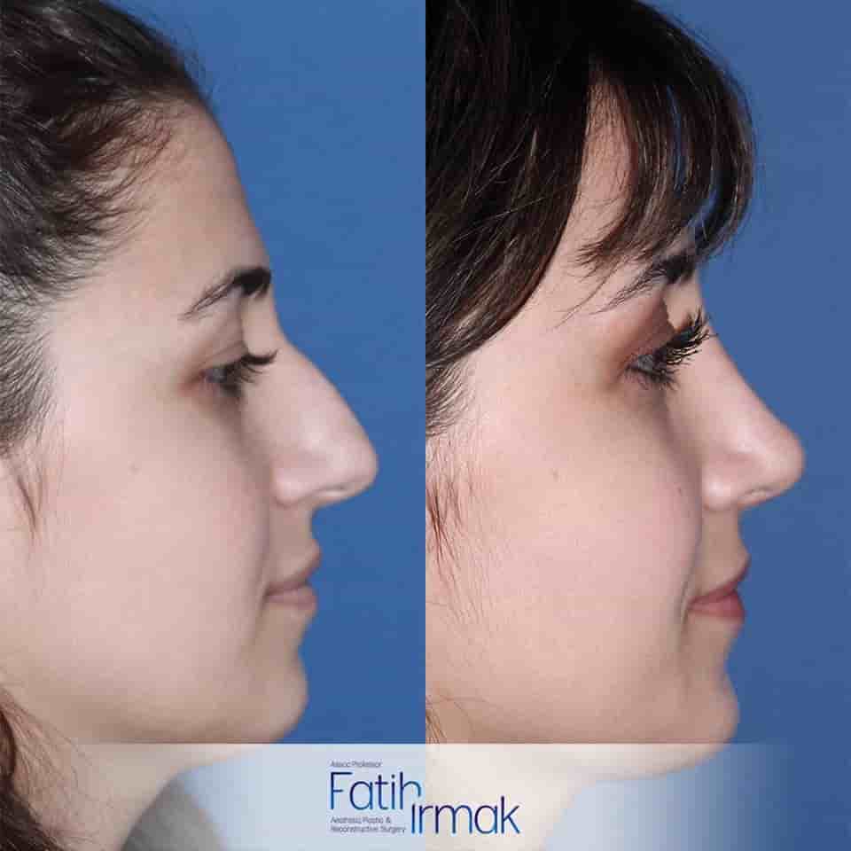 Verifizierte Patientenbewertungen von Assoc. Prof. Fatih Irmak Aesthetic and Plastic Surgery Clinic in Istanbul, Turkey Slider image 3