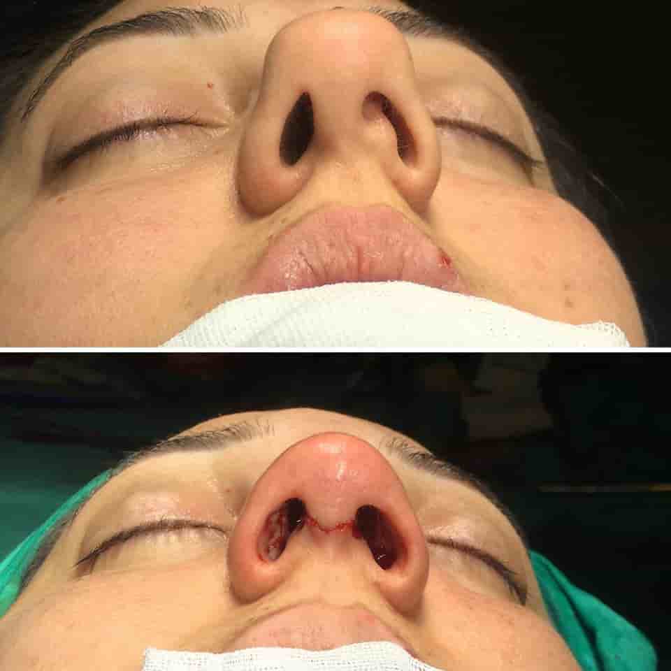 Verifizierte Patientenbewertungen von Estetik Center Clinic by Dr. Ali Dursun Kan MD in Istanbul, Turkey Slider image 3