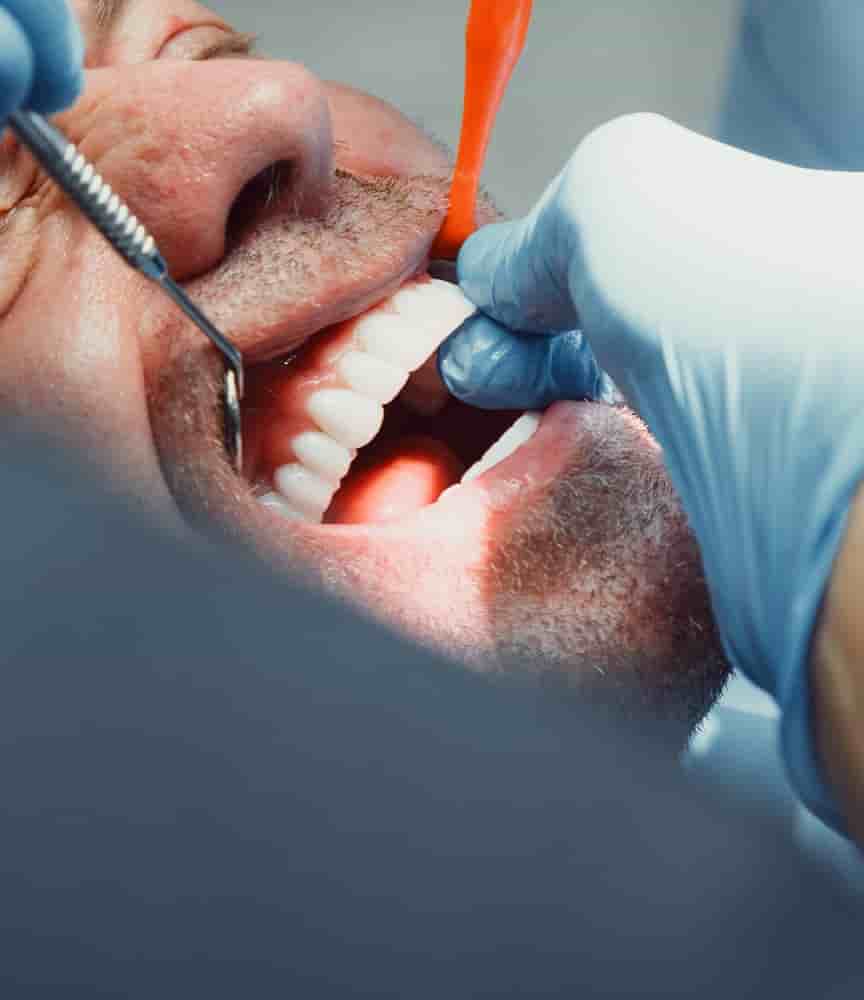 Verifizierte Patientenbewertungen von Beyaz Ada Dental Clinic in Antalya, Turkey Slider image 9