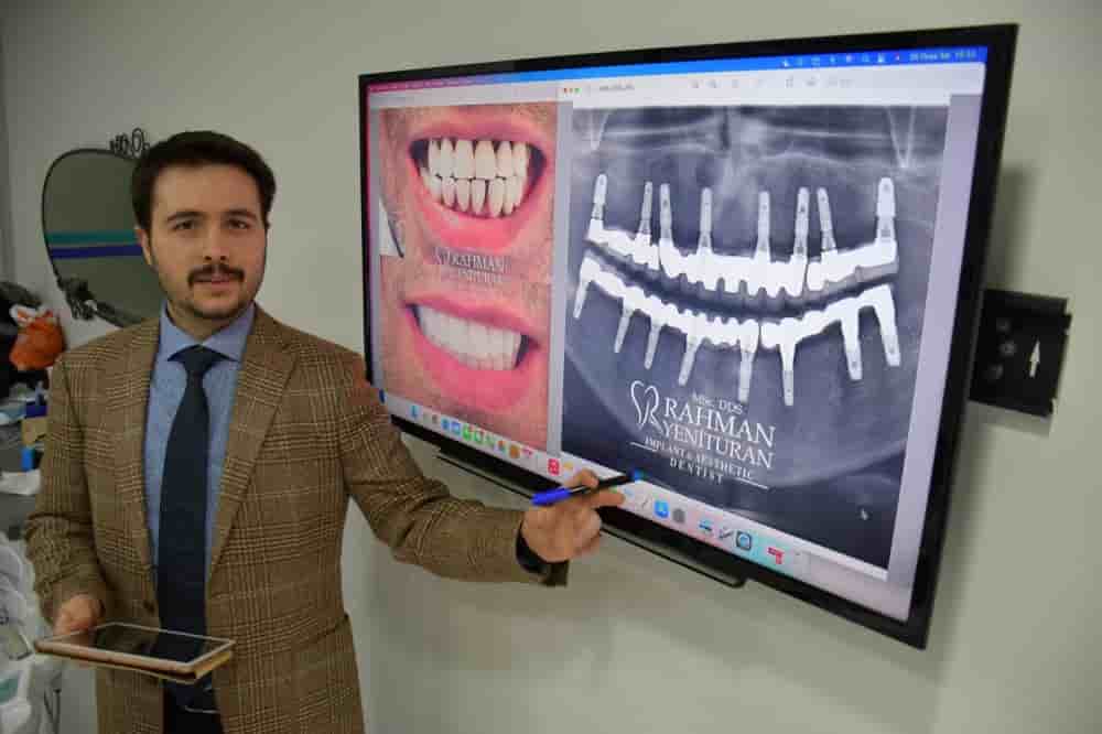 Verifizierte Patientenbewertungen von YKN DENTAL CLINIC in Istanbul, Turkey Slider image 5