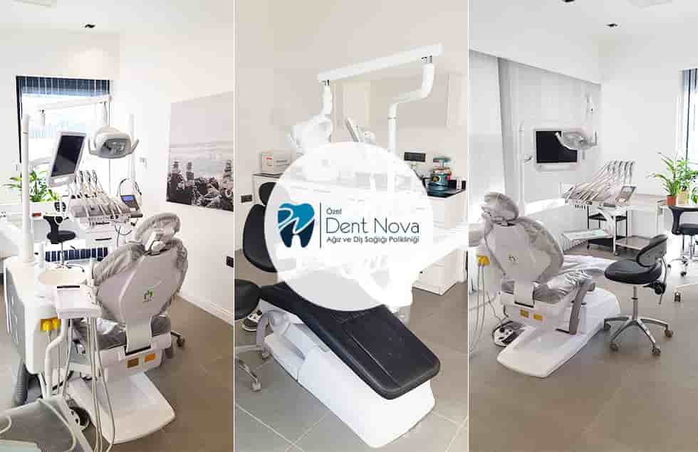 Verifizierte Patientenbewertungen von Dent Nova Dental Clinic in Izmir, Turkey Slider image 3