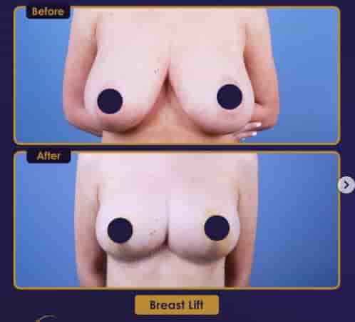 Verifizierte Patientenbewertungen von Estherian Clinic in Istanbul, Turkey Slider image 3