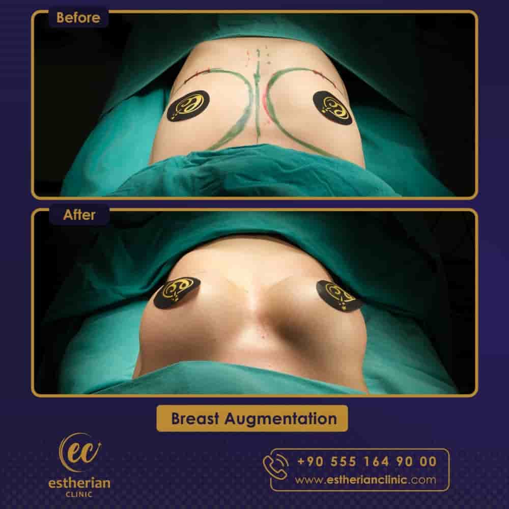 Verifizierte Patientenbewertungen von Estherian Clinic in Istanbul, Turkey Slider image 9