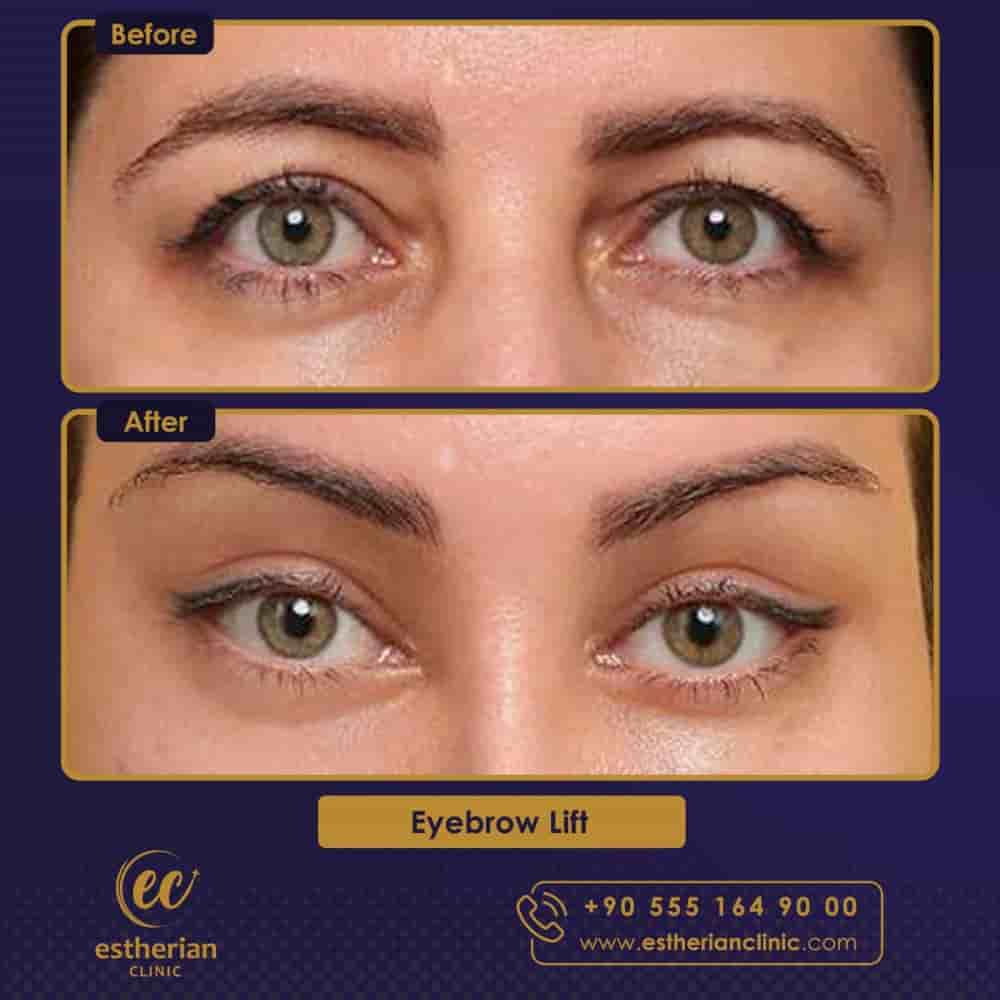 Verifizierte Patientenbewertungen von Estherian Clinic in Istanbul, Turkey Slider image 10