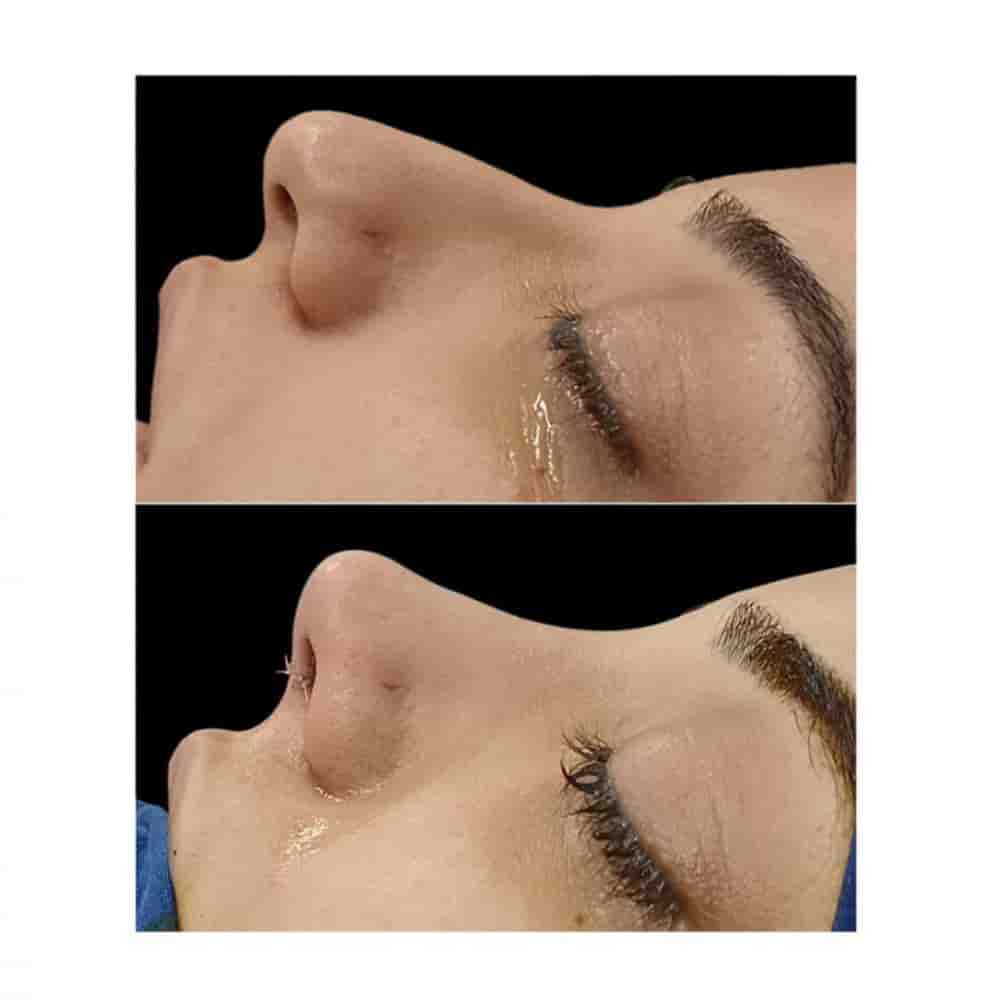 Verifizierte Patientenbewertungen von The Nose Aesthetic Clinic in Istanbul, Turkey Slider image 2