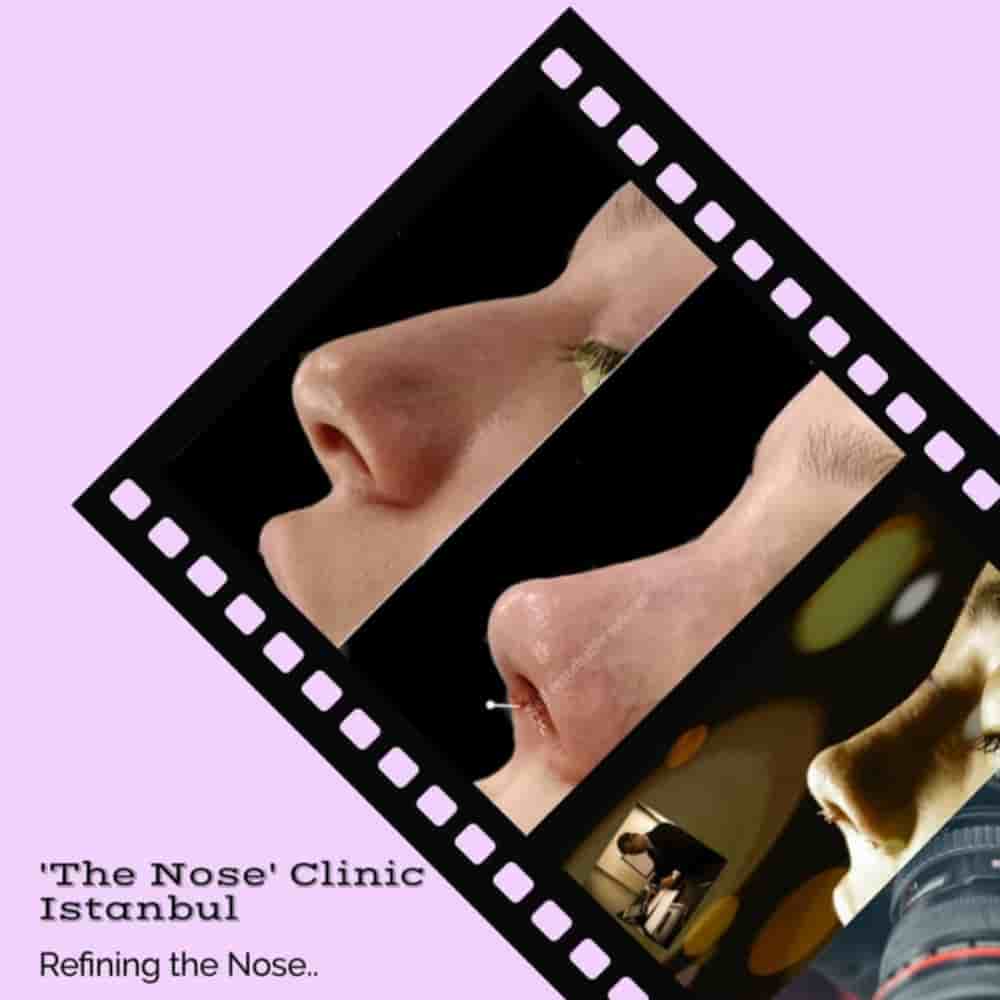 Verifizierte Patientenbewertungen von The Nose Aesthetic Clinic in Istanbul, Turkey Slider image 3