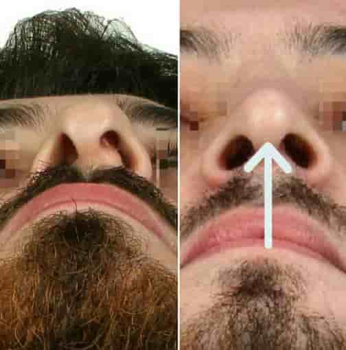 Verifizierte Patientenbewertungen von The Nose Aesthetic Clinic in Istanbul, Turkey Slider image 5