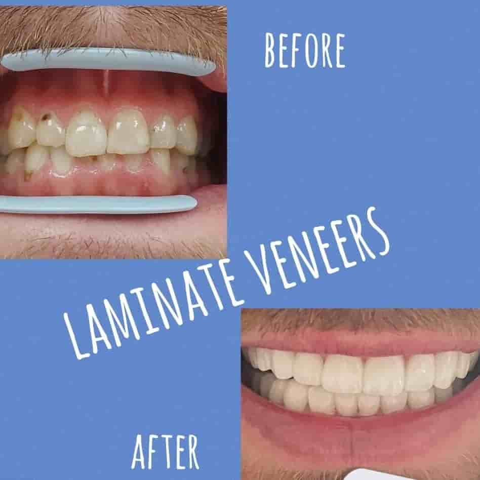 Verifizierte Patientenbewertungen von Park Dental Clinic in Aydin, Turkey Slider image 4