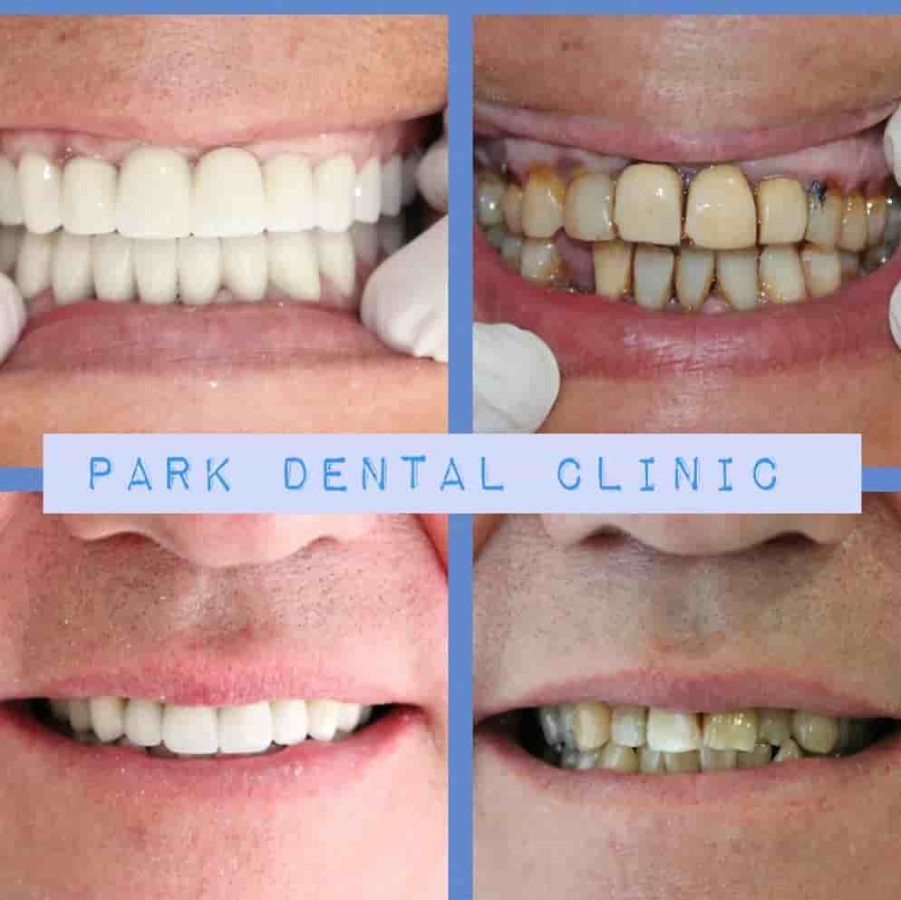 Verifizierte Patientenbewertungen von Park Dental Clinic in Aydin, Turkey Slider image 6