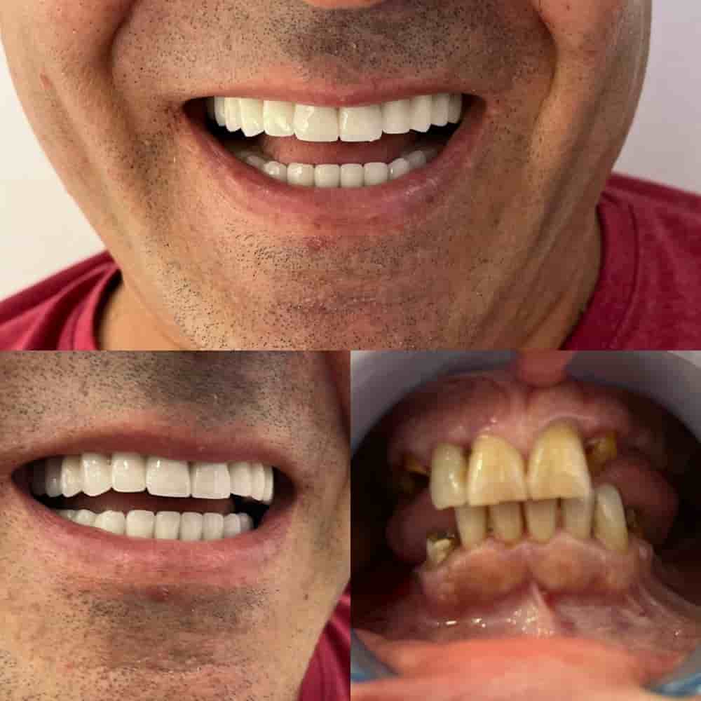 Verifizierte Patientenbewertungen von Zirve Dental in Aydin, Turkey Slider image 9