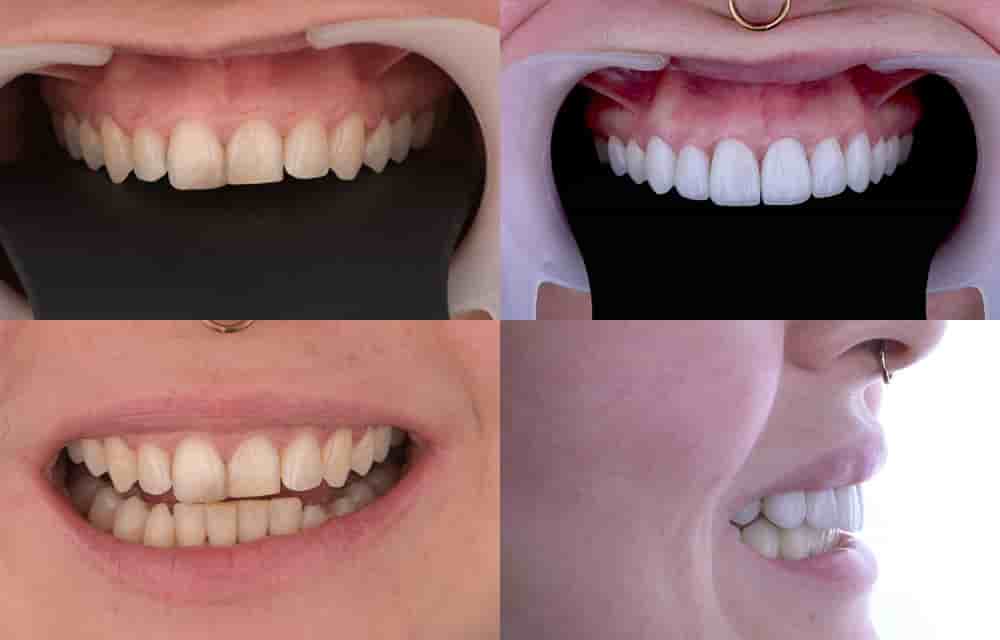 Verifizierte Patientenbewertungen von Dentleon Polyclinics in Izmir, Turkey Slider image 4