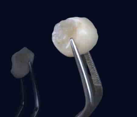 Verifizierte Patientenbewertungen von Smile Zone Clinic in Ankara, Turkey Slider image 2