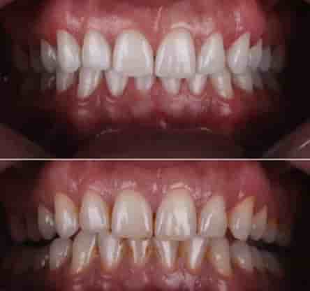 Verifizierte Patientenbewertungen von Smile Zone Clinic in Ankara, Turkey Slider image 4