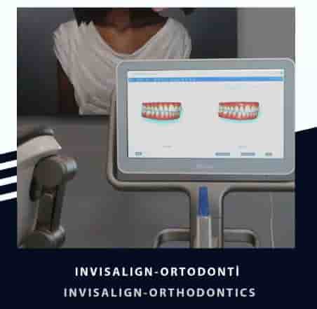 Verifizierte Patientenbewertungen von Smile Zone Clinic in Ankara, Turkey Slider image 5