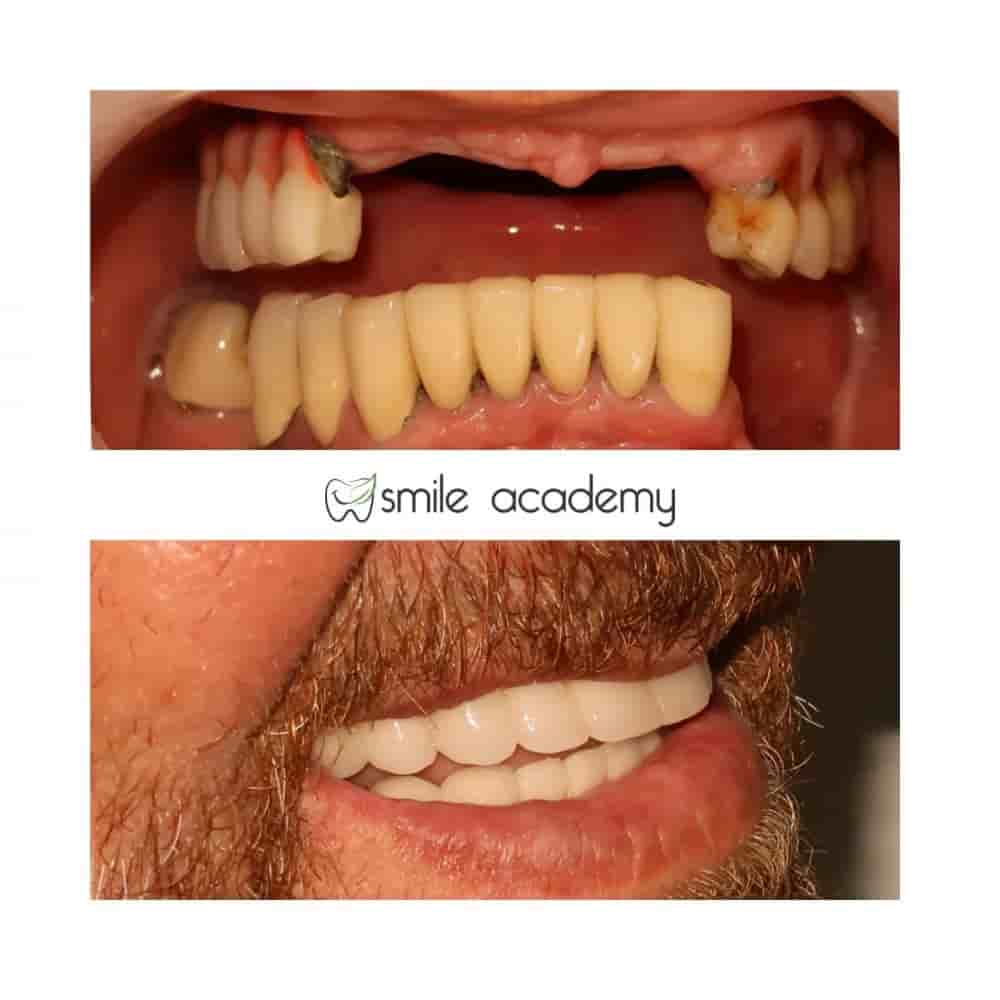 Verifizierte Patientenbewertungen von Esthetic Smile Academy  in Istanbul, Turkey Slider image 2