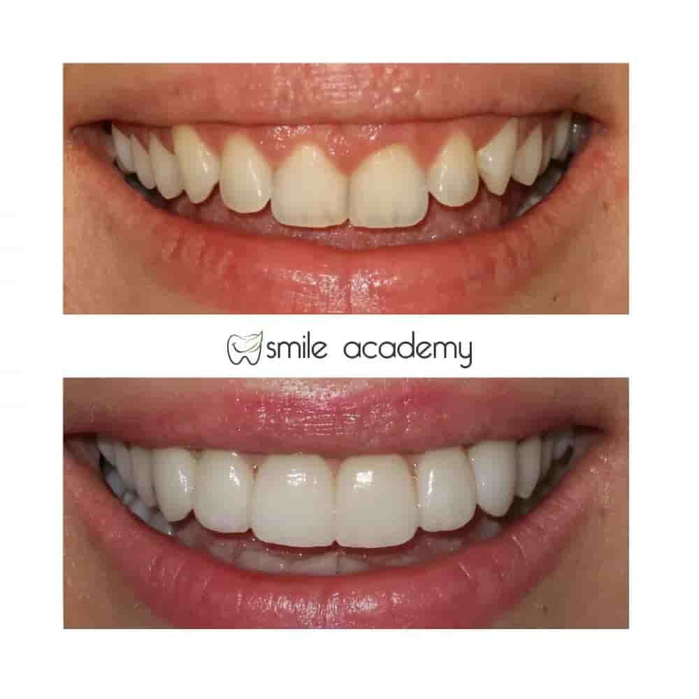 Verifizierte Patientenbewertungen von Esthetic Smile Academy  in Istanbul, Turkey Slider image 4