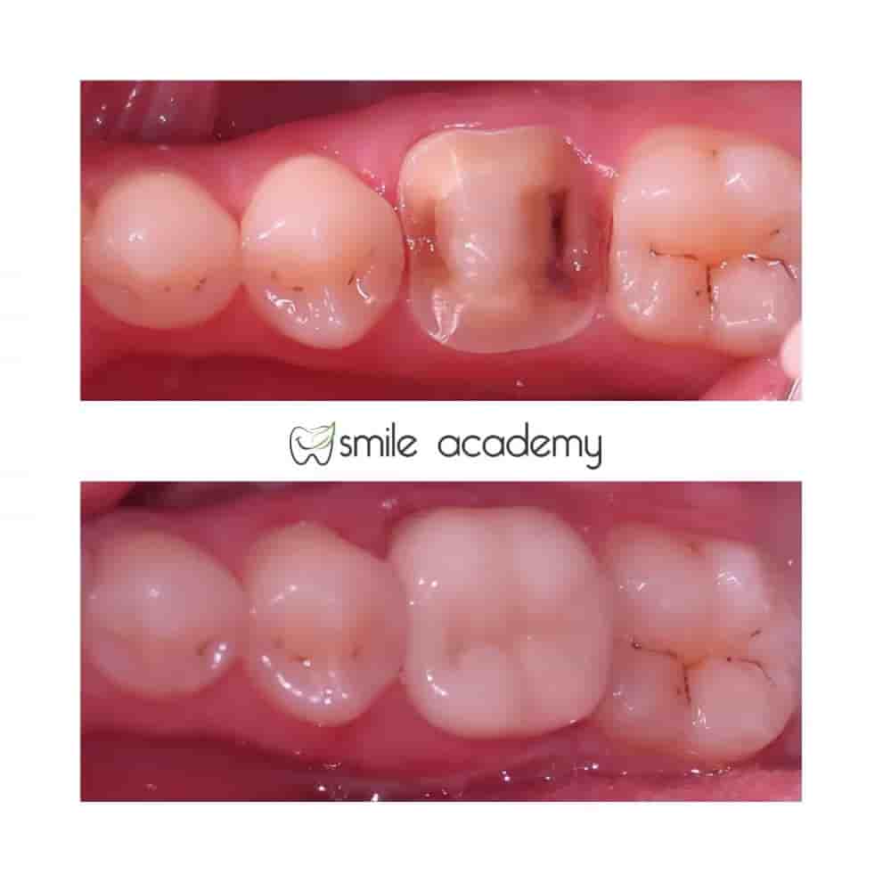 Verifizierte Patientenbewertungen von Esthetic Smile Academy  in Istanbul, Turkey Slider image 7