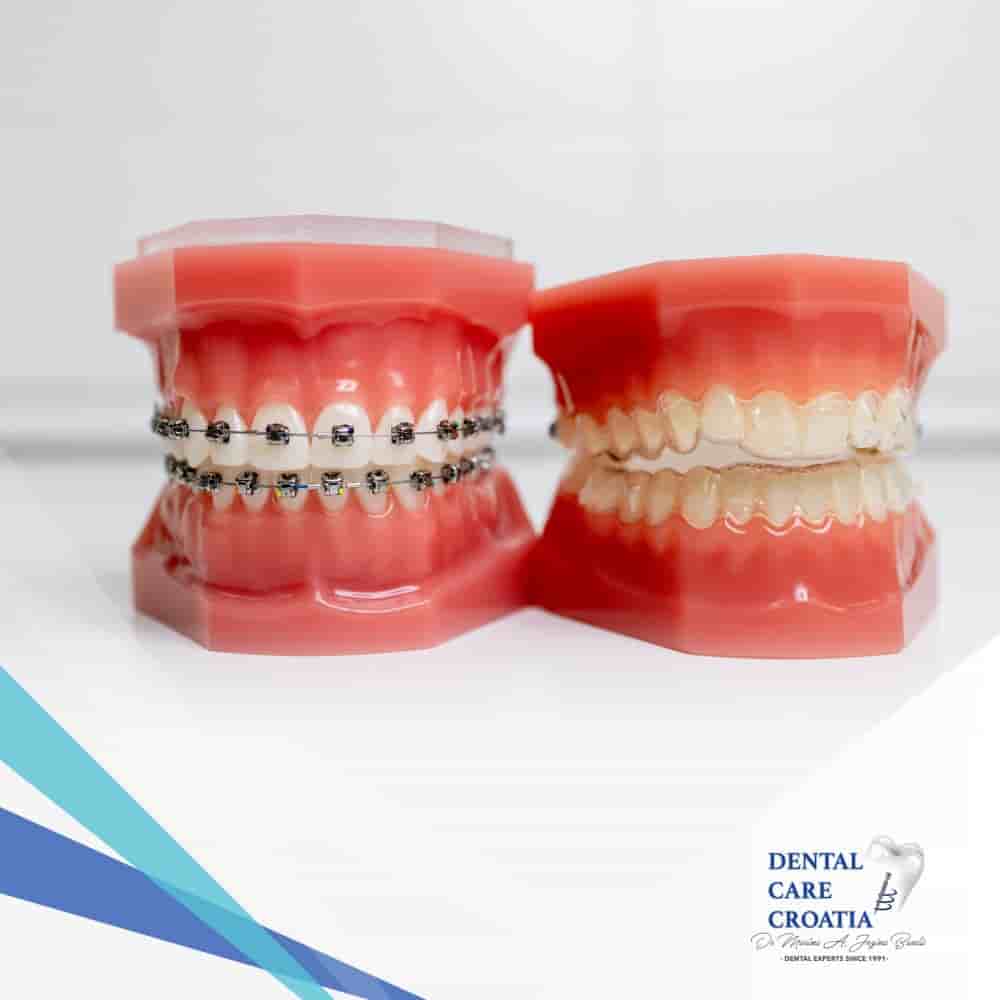 Verifizierte Patientenbewertungen von Dental Care Croatia in Split, Croatia Slider image 3