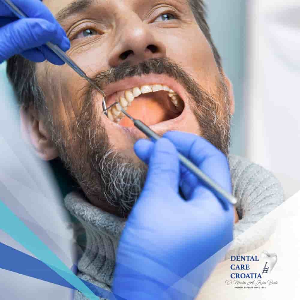 Verifizierte Patientenbewertungen von Dental Care Croatia in Split, Croatia Slider image 7