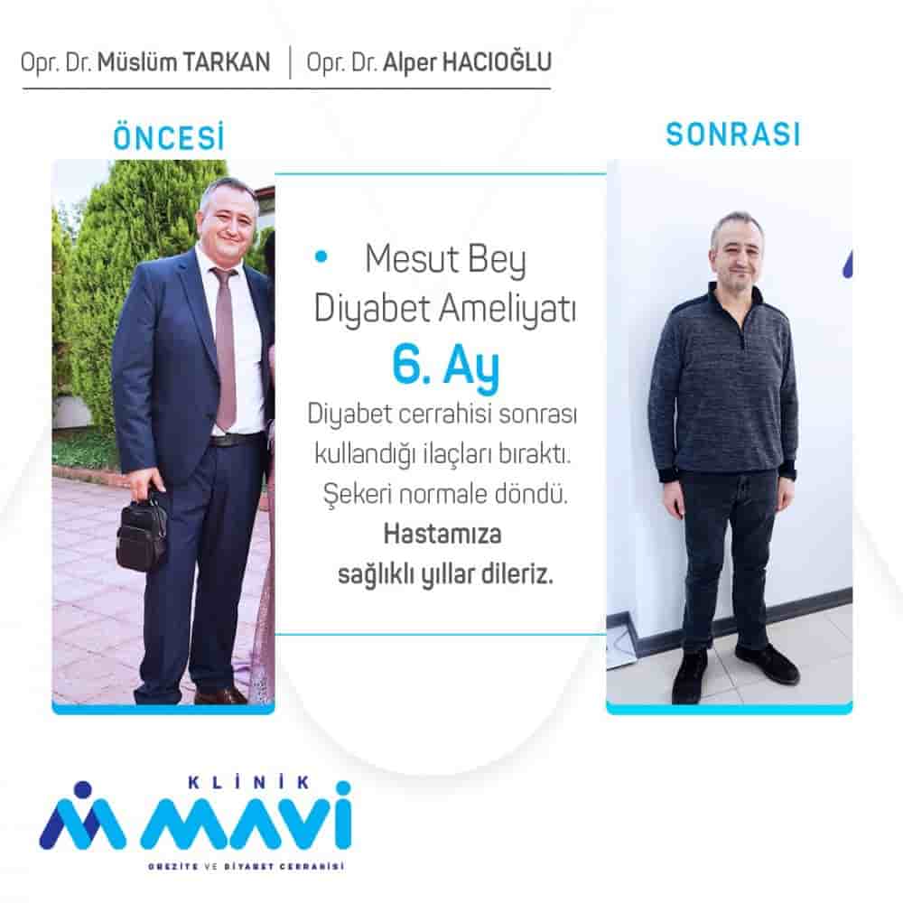 Verifizierte Patientenbewertungen von Klinik Mavi in Eskisehir, Turkey Slider image 4