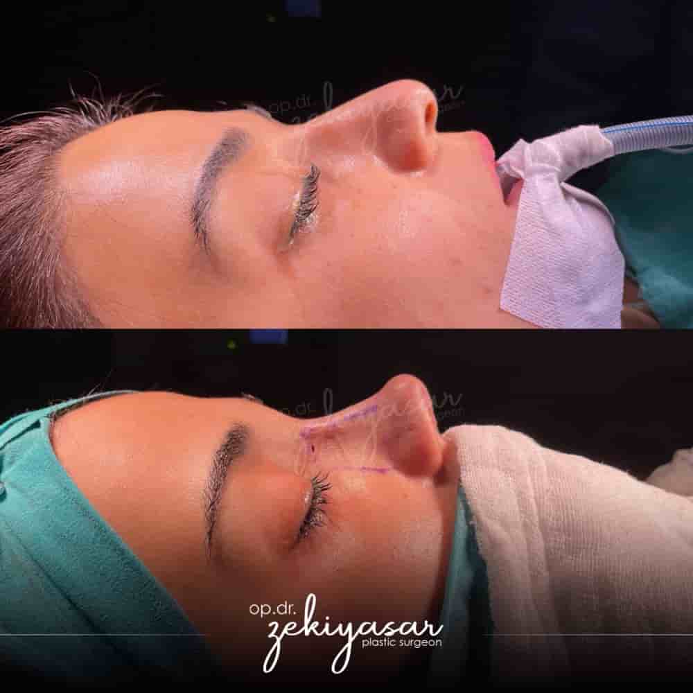 Verifizierte Patientenbewertungen von Dr. Zeki Yasar Clinic in Istanbul, Turkey Slider image 4