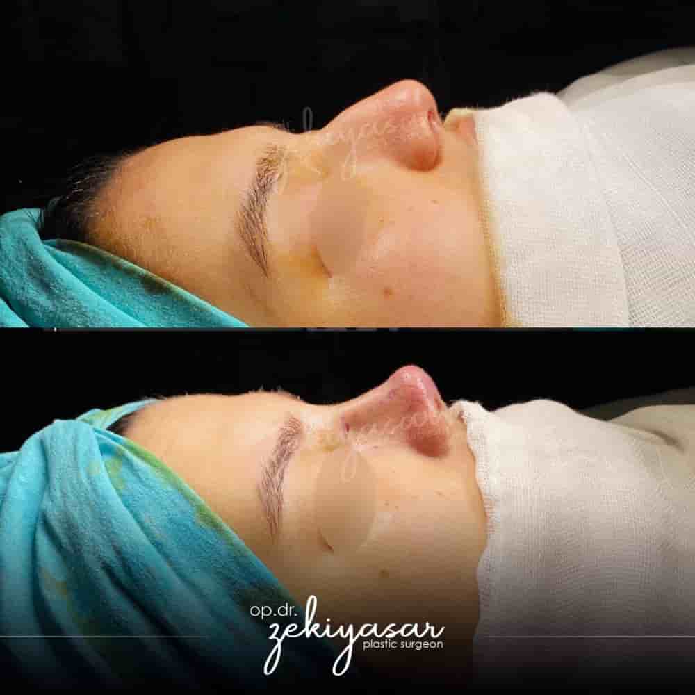 Verifizierte Patientenbewertungen von Dr. Zeki Yasar Clinic in Istanbul, Turkey Slider image 6