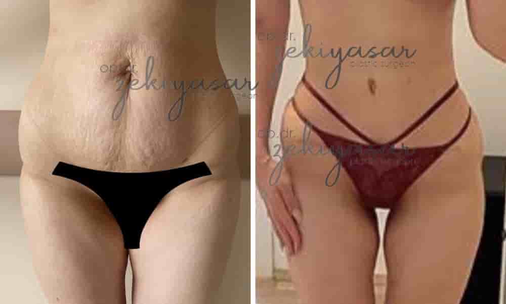 Verifizierte Patientenbewertungen von Dr. Zeki Yasar Clinic in Istanbul, Turkey Slider image 5