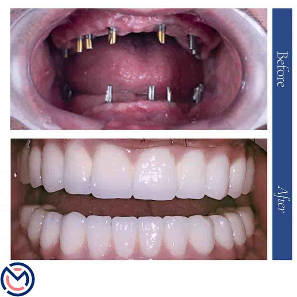 Verifizierte Patientenbewertungen von Medicall Me in Istanbul, Turkey Slider image 7