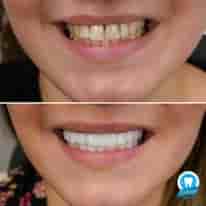 Verifizierte Patientenbewertungen von Turkiye Dental in , Turkey Slider image 4