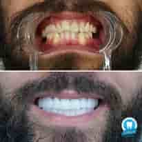 Verifizierte Patientenbewertungen von Turkiye Dental in , Turkey Slider image 5