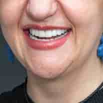 Verifizierte Patientenbewertungen von Turkiye Dental in , Turkey Slider image 7
