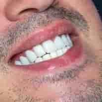 Verifizierte Patientenbewertungen von Turkiye Dental in , Turkey Slider image 8
