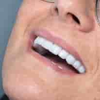 Verifizierte Patientenbewertungen von Turkiye Dental in , Turkey Slider image 10