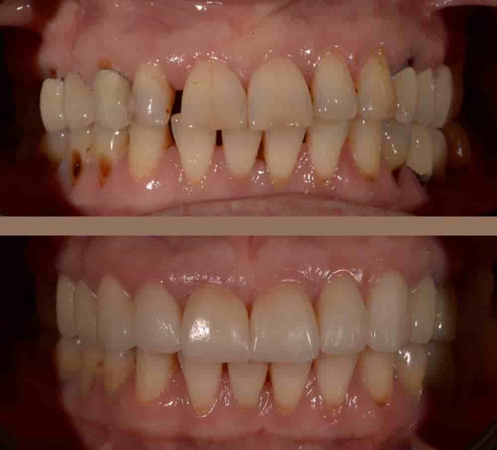 Verifizierte Patientenbewertungen von UltimaDent in Izmir, Turkey Slider image 1