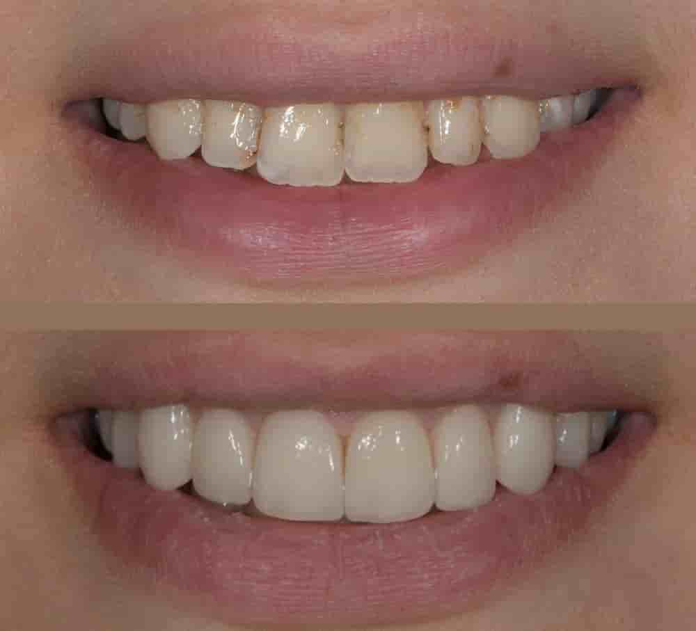Verifizierte Patientenbewertungen von UltimaDent in Izmir, Turkey Slider image 3