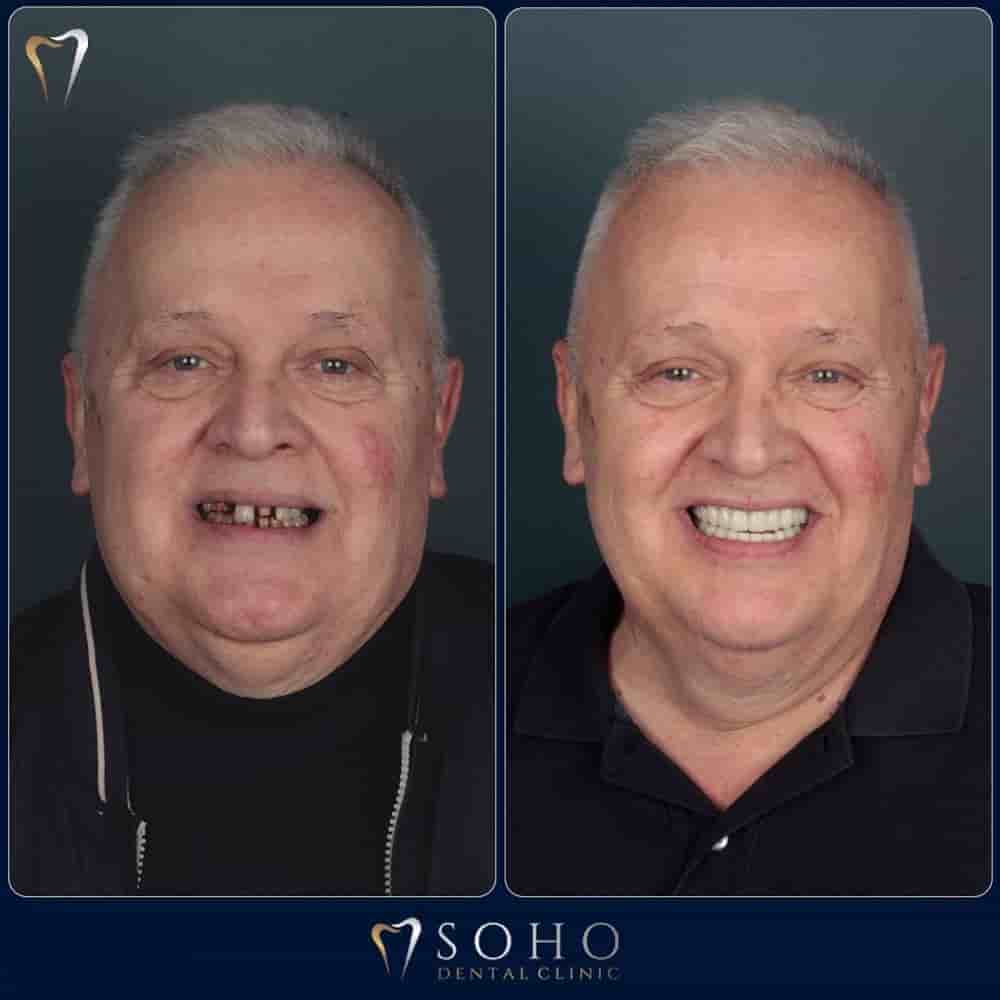 Verifizierte Patientenbewertungen von Soho Dental Clinic in Istanbul, Turkey Slider image 1