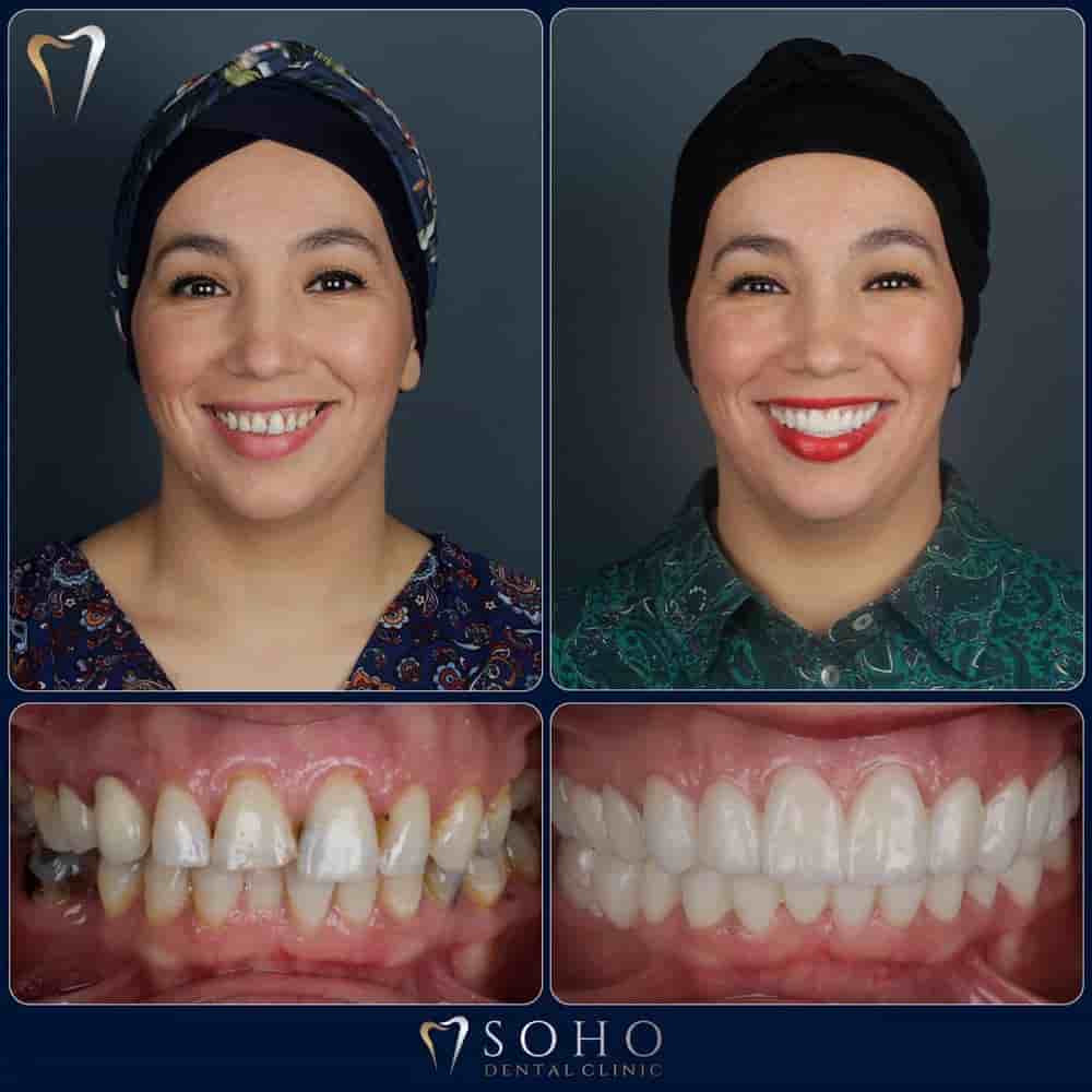 Verifizierte Patientenbewertungen von Soho Dental Clinic in Istanbul, Turkey Slider image 3