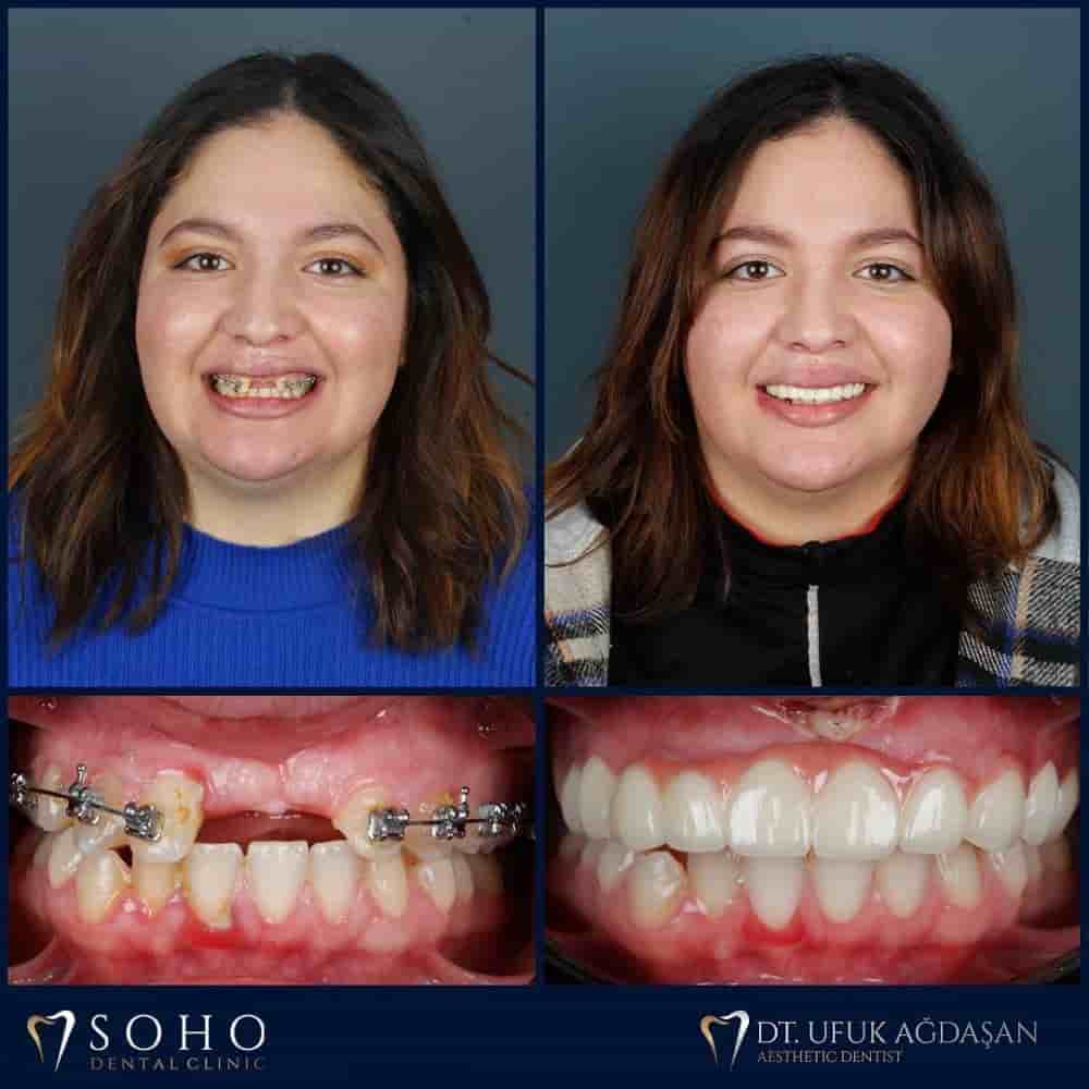 Verifizierte Patientenbewertungen von Soho Dental Clinic in Istanbul, Turkey Slider image 7