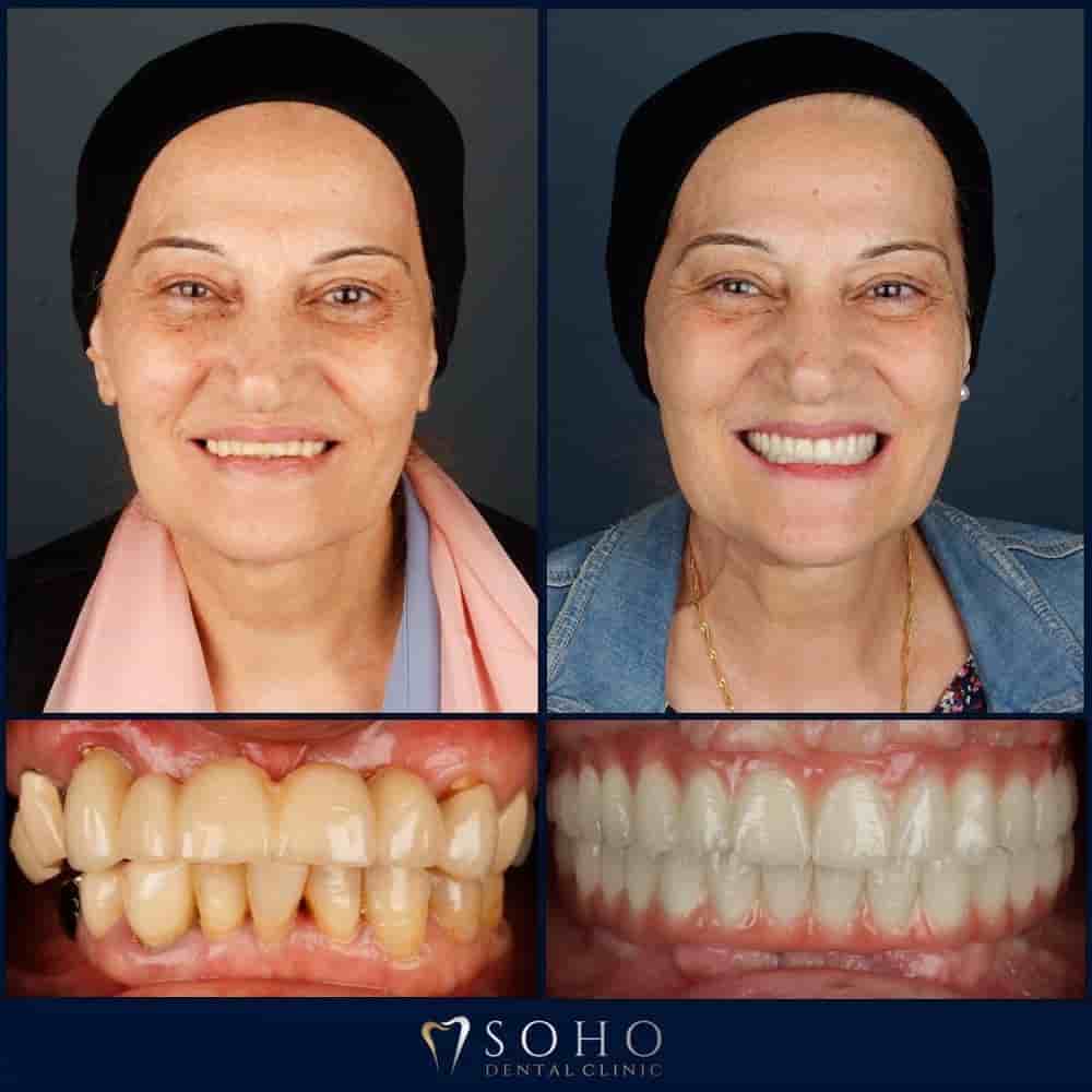 Verifizierte Patientenbewertungen von Soho Dental Clinic in Istanbul, Turkey Slider image 8