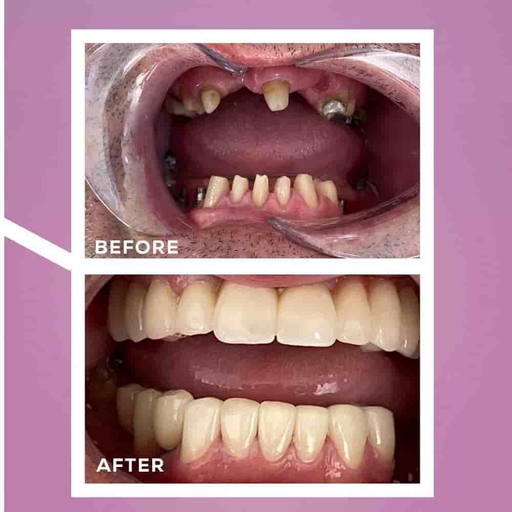 Verifizierte Patientenbewertungen von Dent Antalya in Antalya, Turkey Slider image 5