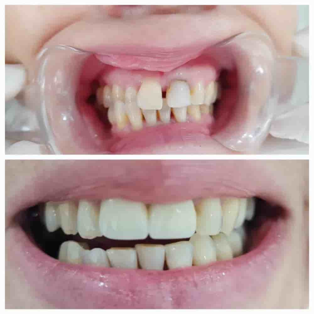 Verifizierte Patientenbewertungen von Prestij Dental Clinic in Antalya, Turkey Slider image 6