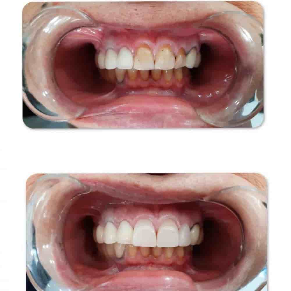 Verifizierte Patientenbewertungen von Prestij Dental Clinic in Antalya, Turkey Slider image 7